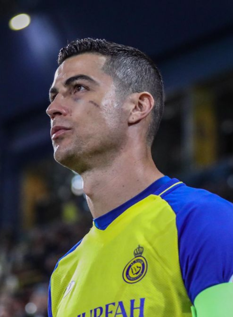 Ronaldo is not the winner of the Saudi Arabian League.